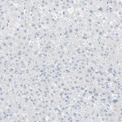 Integrin beta 4/CD104 Antibody (CL6972), Novus Biologicals 25 &mu;L; Integrin